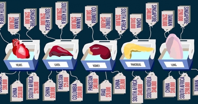 Image shows how much an organ is worth in different countries. Photo by dresember.org